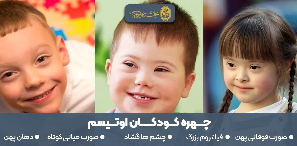چهره کودکان اوتیسم- اوتیسم چیست- علائم اوتیسم