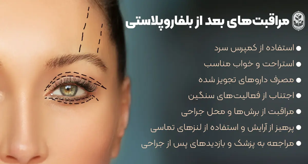 بلفاروپلاستی چگونه انجام میشود- مراقبت های بعد از عمل بلفاروپلاستی