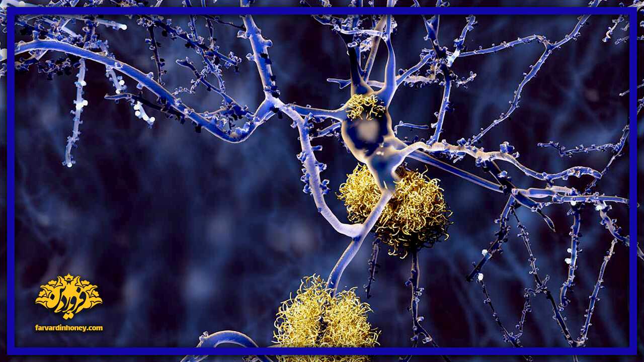 درمان آلزایمر - عسل فروردین