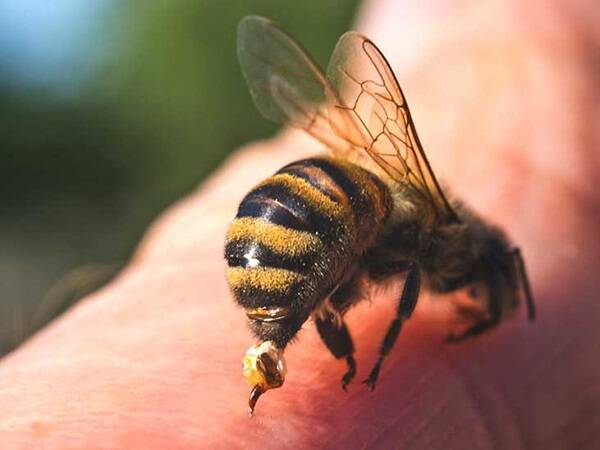 درمان نیش زنبورعسل