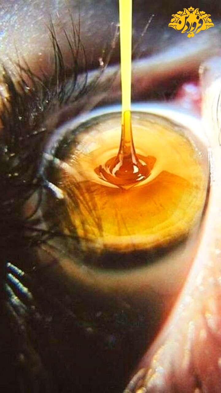 چکاندن عسل طبیعی در چشم-روش ریختن عسل در چشم-نحوه ریختن عسل در چشم-عسل مناسب برای چشم-عسل فروردین