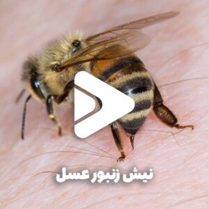 نیش زنبور عسل و 5 نکته حیاتی-عسل فروردین