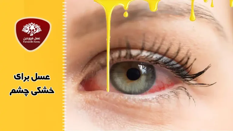 درمان خانگی خشکی چشم با عسل و 5 ماده طبیعی دیگر